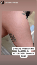 Load image into Gallery viewer, Instagram reviewed cellulite skin care 

